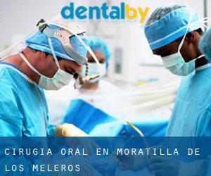 Cirugía Oral en Moratilla de los Meleros