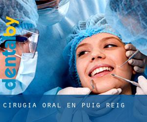 Cirugía Oral en Puig-reig