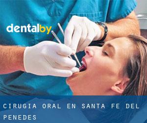 Cirugía Oral en Santa Fe del Penedès