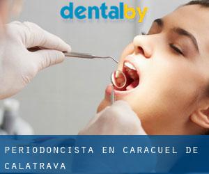 Periodoncista en Caracuel de Calatrava