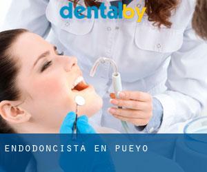 Endodoncista en Pueyo