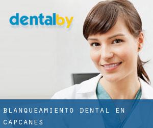 Blanqueamiento dental en Capçanes