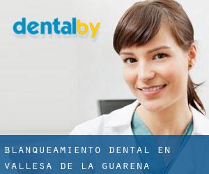 Blanqueamiento dental en Vallesa de la Guareña