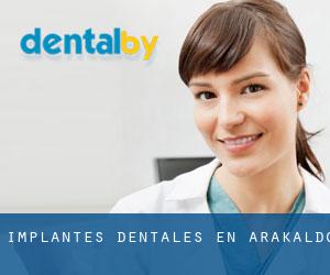 Implantes Dentales en Arakaldo