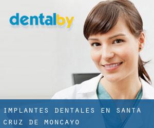 Implantes Dentales en Santa Cruz de Moncayo