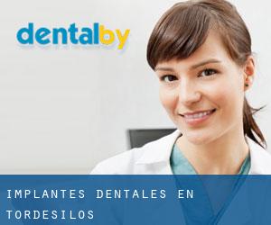 Implantes Dentales en Tordesilos